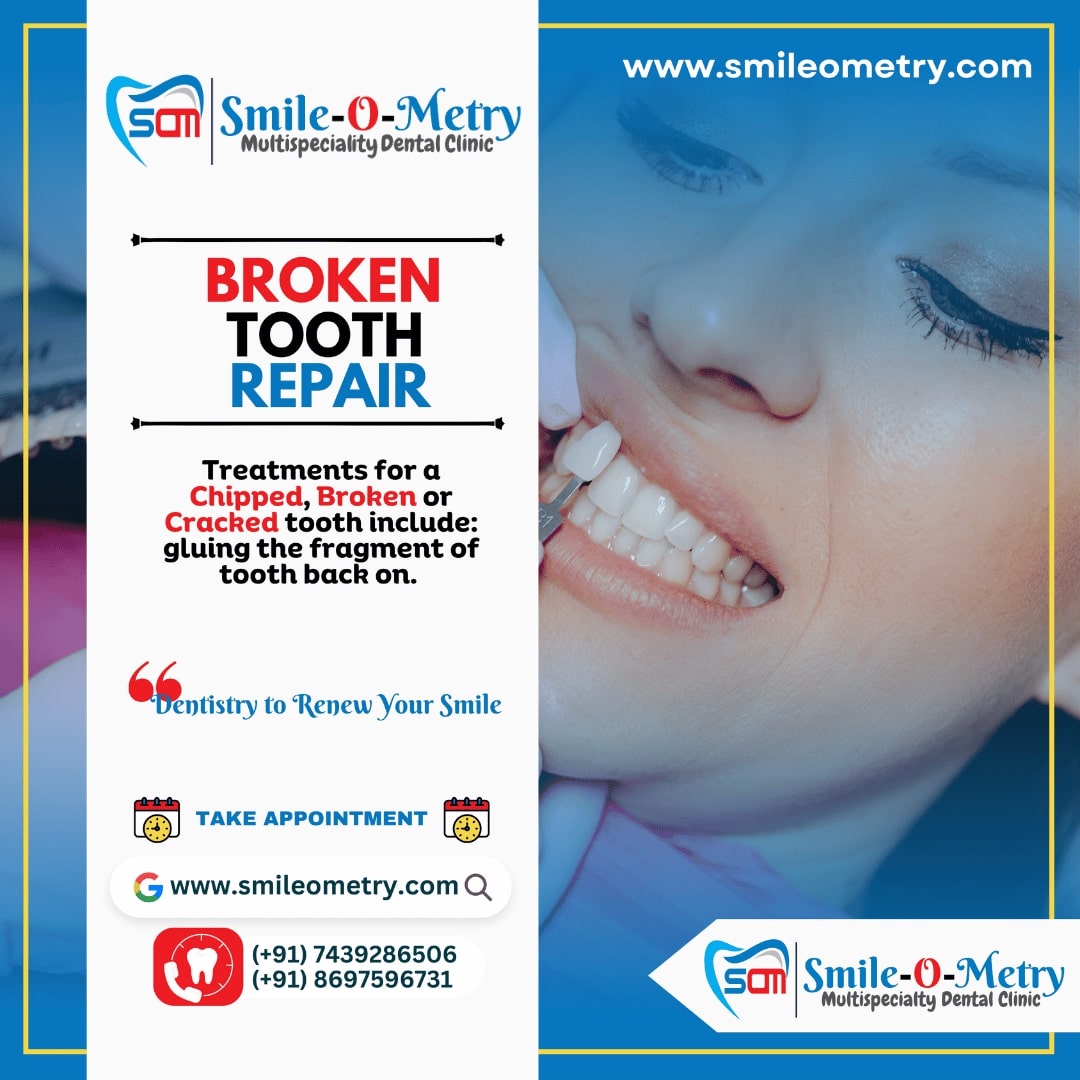 Broken Tooth Repair