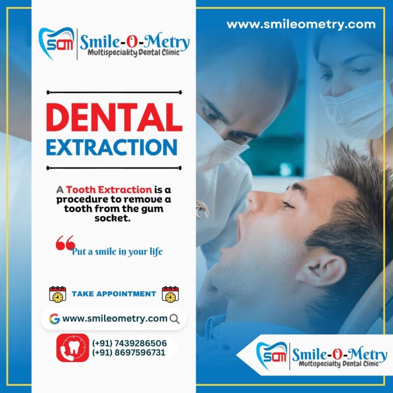 Dental Extraction