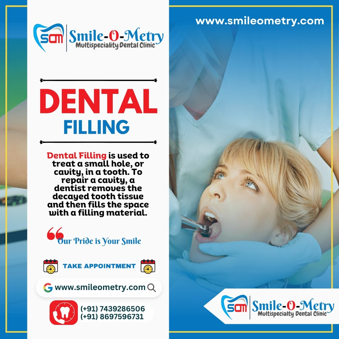 Dental Filling